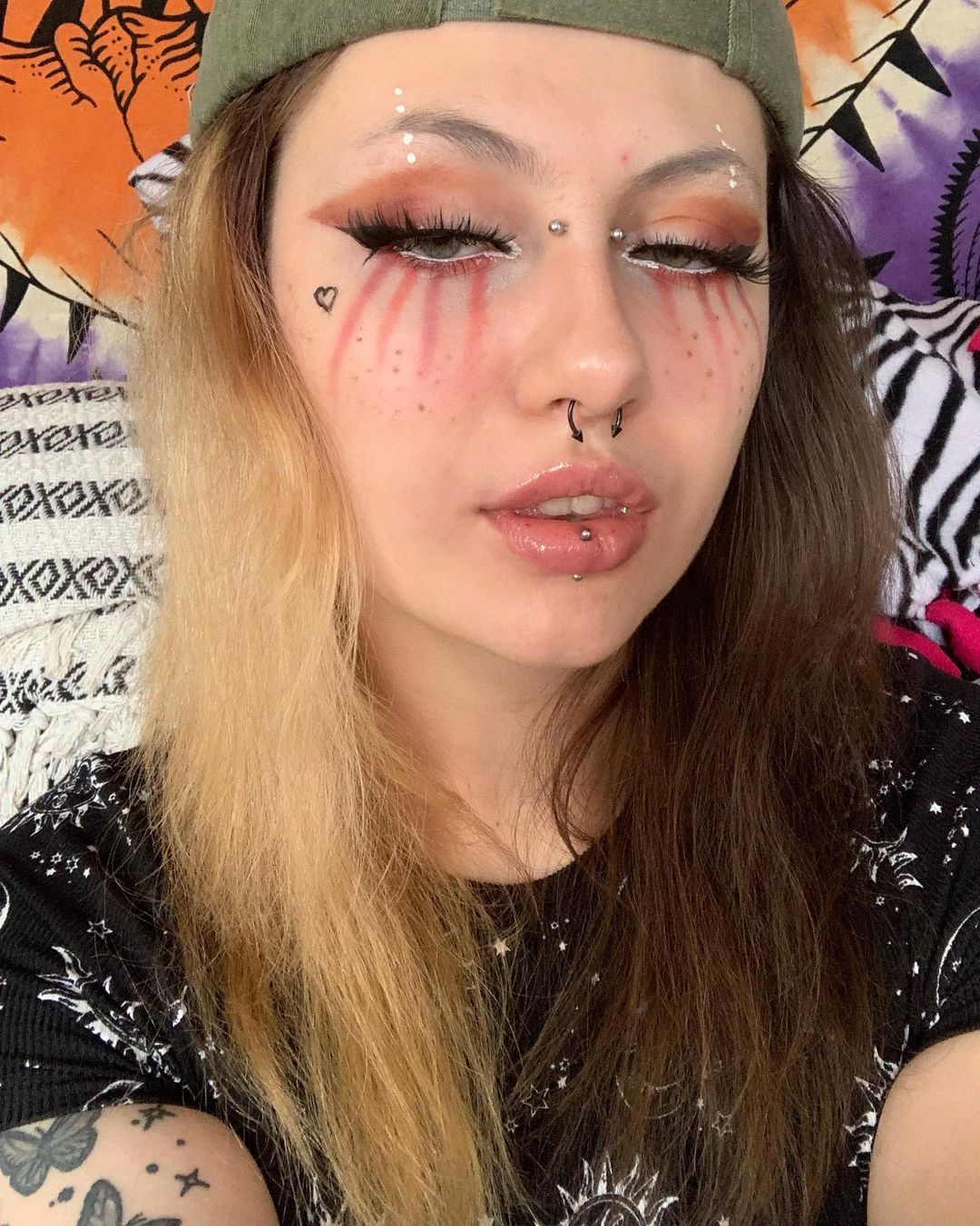 rhi 10
